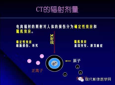 CT扫描探究，一次检查背后的辐射影响分析