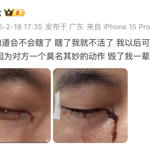 陶勇谈郭艾伦眼部受伤事件，运动员健康与运动安全引发深度思考